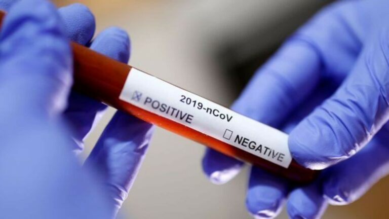 Lajeado registra nesta sexta novo óbito por coronavírus